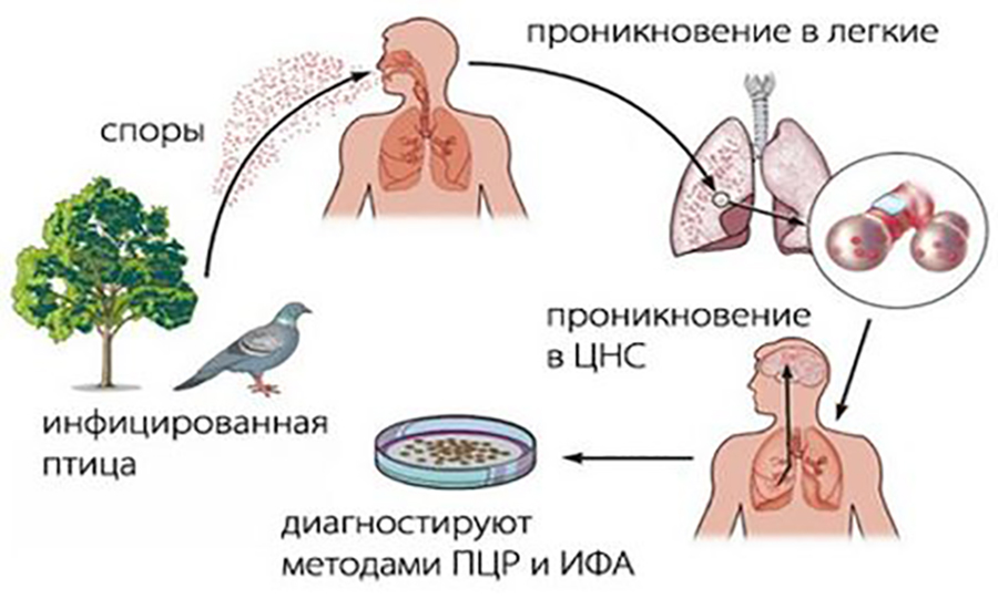 Ð¡ÑÐµÐ¼Ð° Ð·Ð°ÑÐ°Ð¶ÐµÐ½Ð¸Ñ Ð¾ÑÐ½Ð¸ÑÐ¾Ð·Ð¾Ð¼ ÑÐµÐ»Ð¾Ð²ÐµÐºÐ°